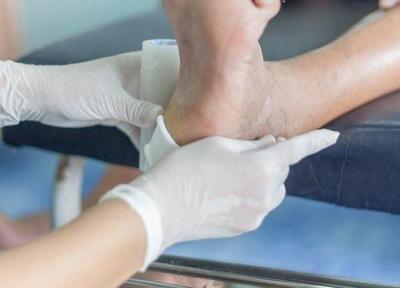 به کارگیری روش بومی ترمیم زخم پای دیابتی با لارو مگس