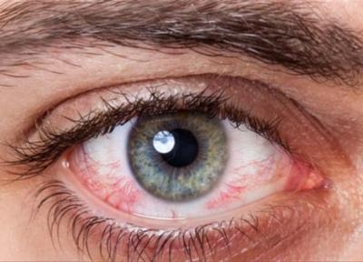 به تعویق انداختن درمان کدام یک از بیماری&zwnjهای چشمی خطرناک است؟